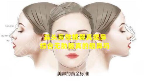 蒜头鼻做蝶翼真揉鼻综合无肋能真的翘鼻吗