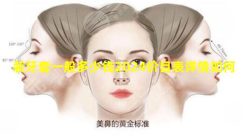 装牙套一般多少钱2024价目表详情如何