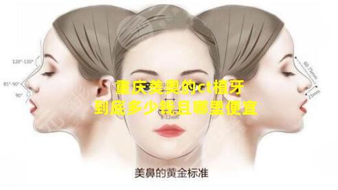 重庆美奥的ct植牙到底多少钱且哪里便宜