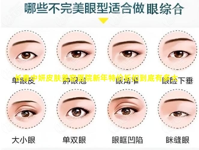 长春中妍皮肤美容医院新年特价折扣到底有多大