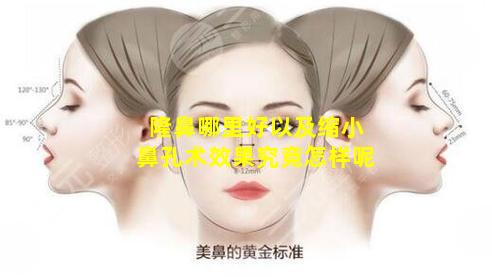 隆鼻哪里好以及缩小鼻孔术效果究竟怎样呢