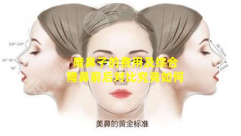 隆鼻子的费用及综合隆鼻前后对比究竟如何