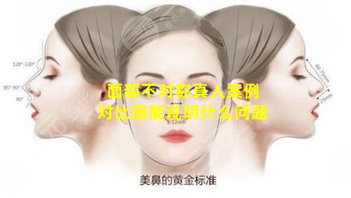 面部不对称真人案例对比图能说明什么问题