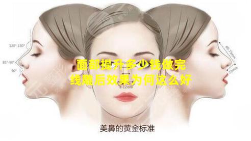 面部提升多少钱做完线雕后效果为何这么好