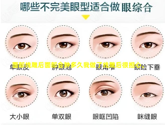 面部线雕后面部会肿多久我做了线雕后很担心。
