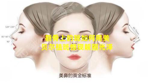 颧骨上的斑如何用美贝尔祛斑惊现靓丽光泽
