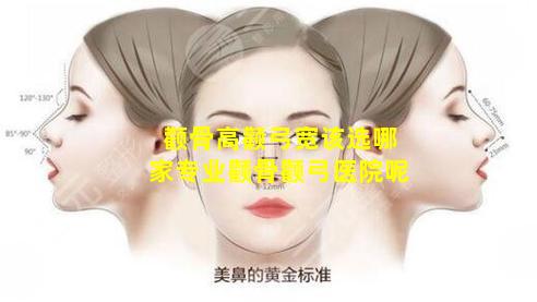 颧骨高颧弓宽该选哪家专业颧骨颧弓医院呢