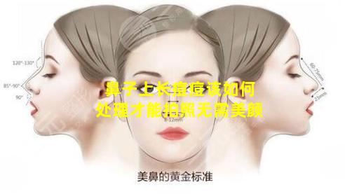 鼻子上长痘痘该如何处理才能拍照无需美颜