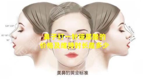 鼻子打一针玻尿酸的价格及维持时长是多少