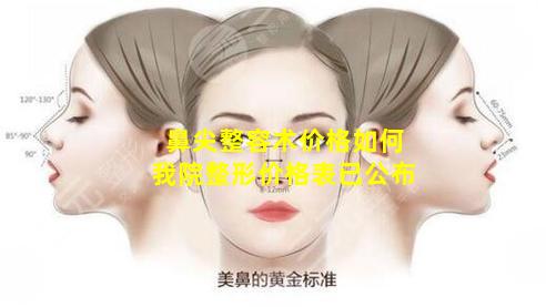 鼻尖整容术价格如何我院整形价格表已公布